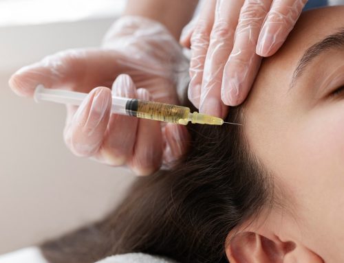 How Effective Is PRP for Hair Loss & Hair Growth?
