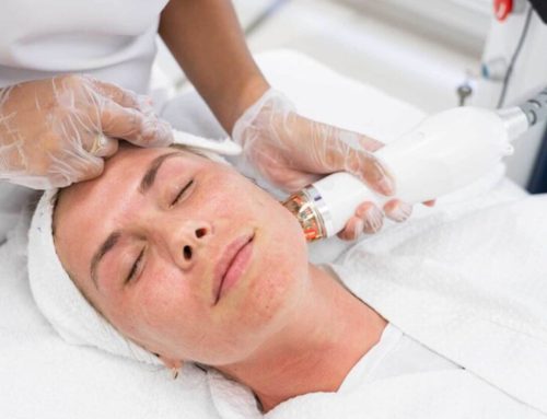 Does Secret RF Microneedling Work? Everything You Need to Know About This Skin Treatment