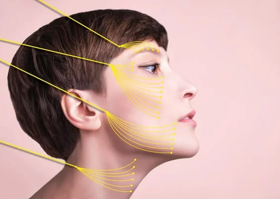 Is Thread Lift Painful? | EverYoung Skin Clinic Vancouver