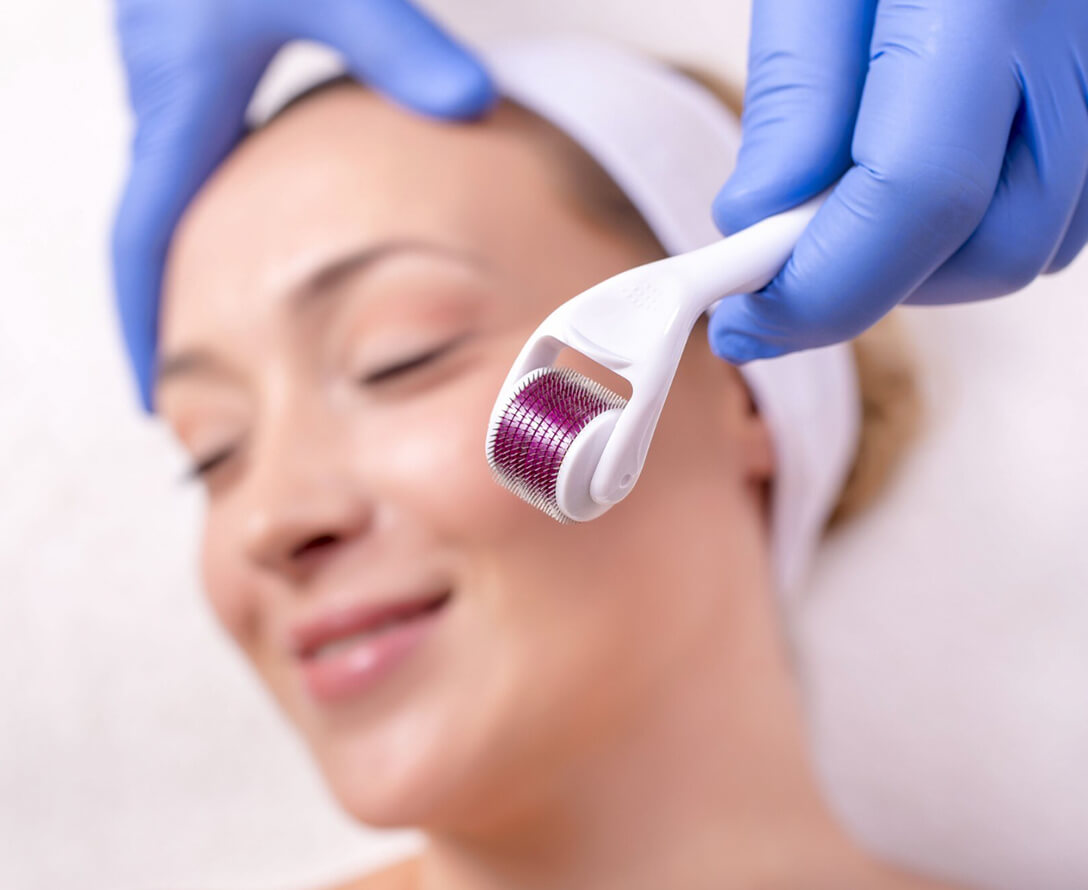 How to Take Care of Your Skin After Microneedling | EverYoung Skin Care Clinic Vancouver