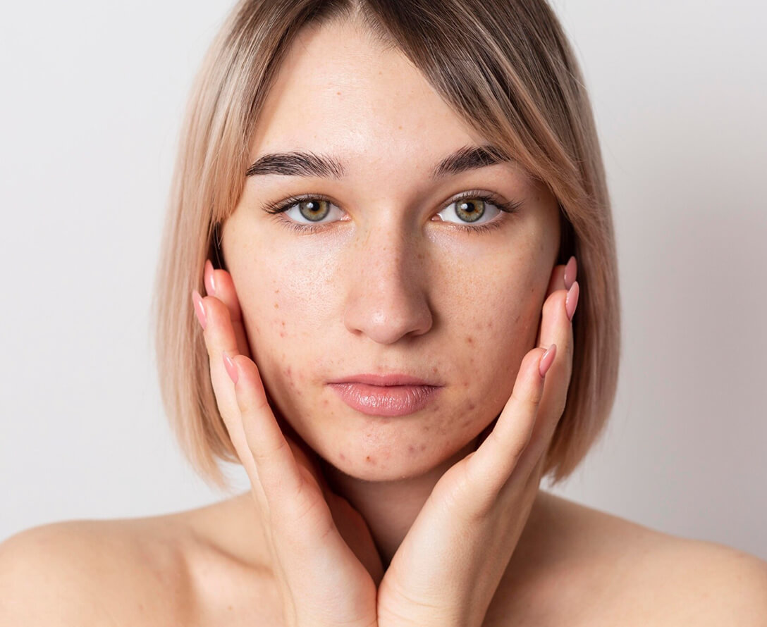 Non-Invasive Treatments | EverYoung Skin Care Clinic Vancouver