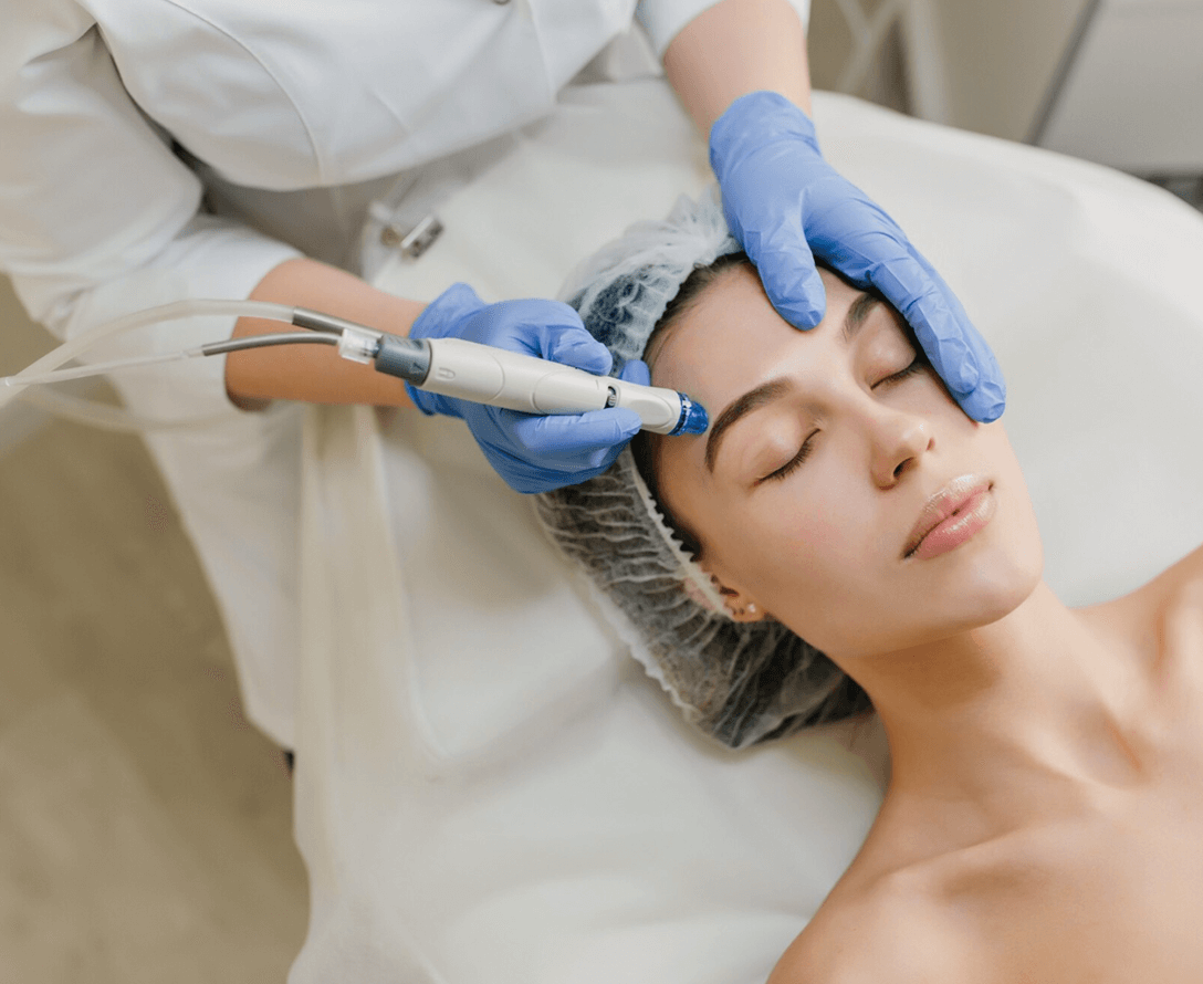 SecretRF Skin Tightening and Non-Surgical Facelift | EverYoung Skin Clinic