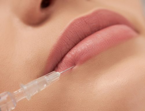 Types of Lip Filler Shapes & Which One is Right for You?