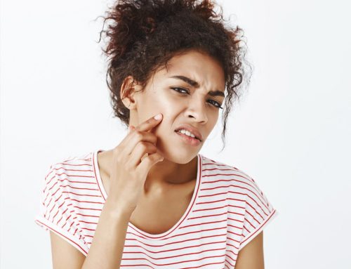 The Ultimate Guide to Acne Treatment