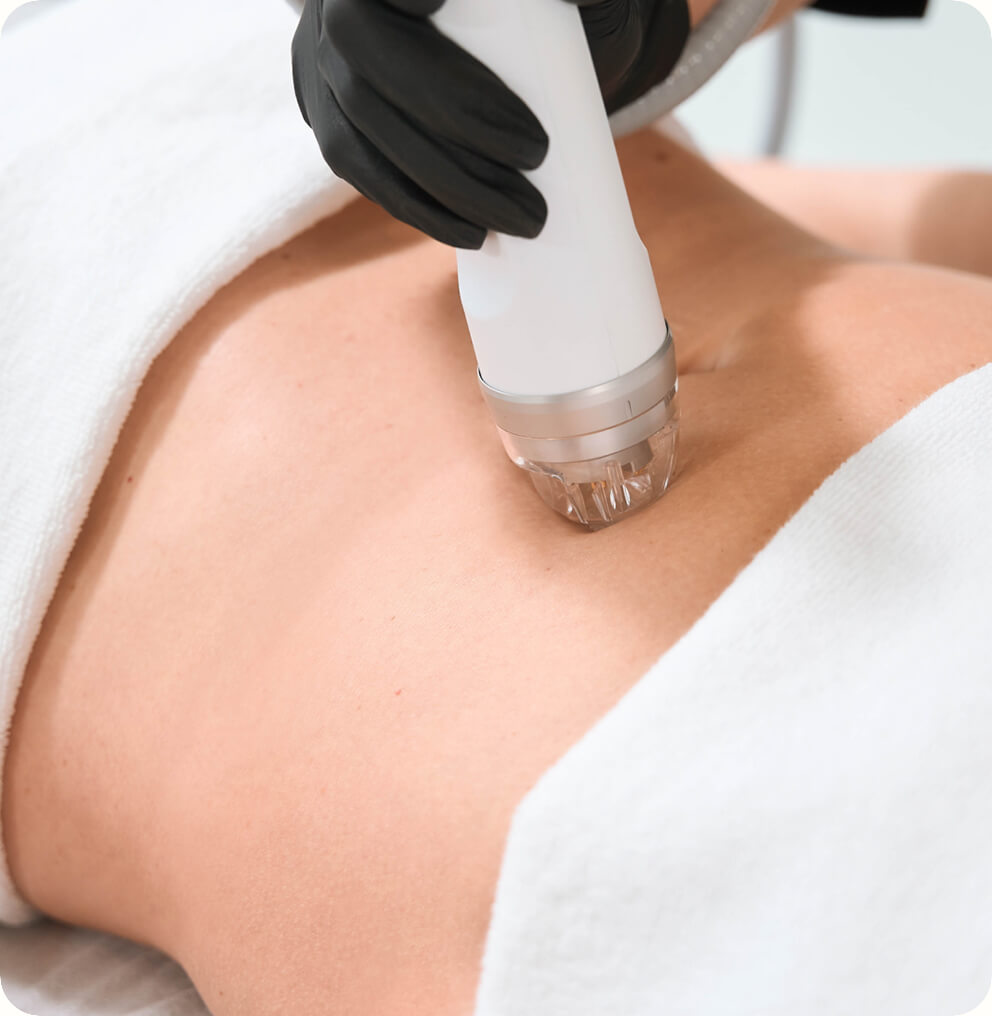 RF Skin Tightening in Vancouver | EverYoung Skin Clinic