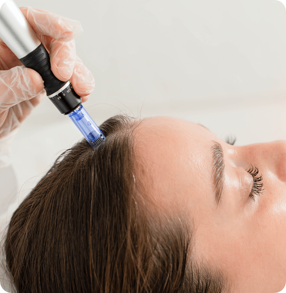 Exosomes Treatment in Vancouver | EverYoung Skin Clinic