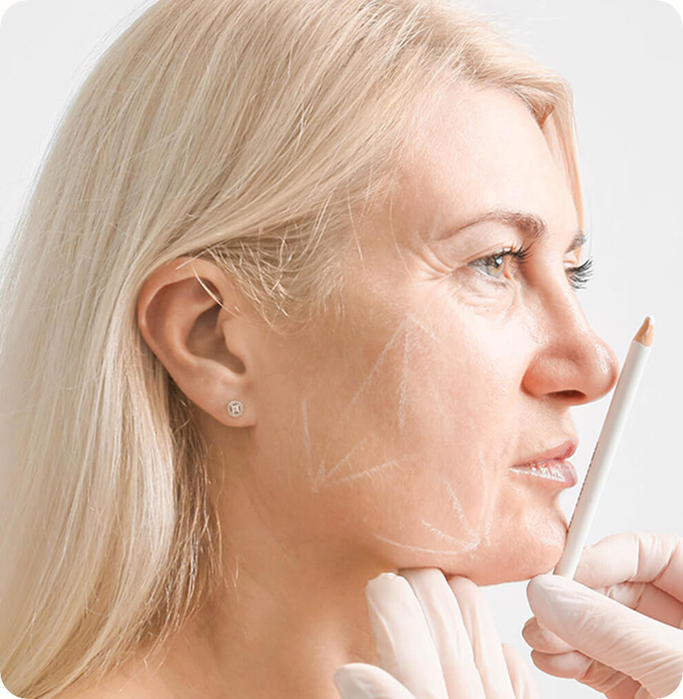 Sculptra Fillers Vancouver | EverYoung Skin Clinic