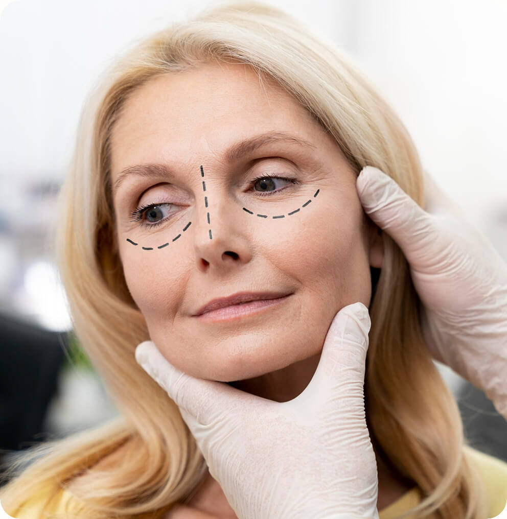 Thread Lifting in Vancouver | EverYoung Skin Clinic