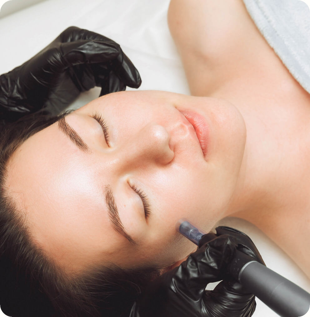 Platelet-Rich Plasma (PRP) Vancouver | EverYoung Skin Clinic