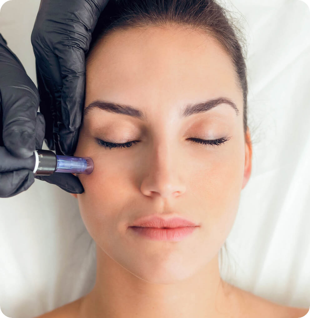 PRP Treatment | Platelet-Rich Plasma | EverYoung Vancouver