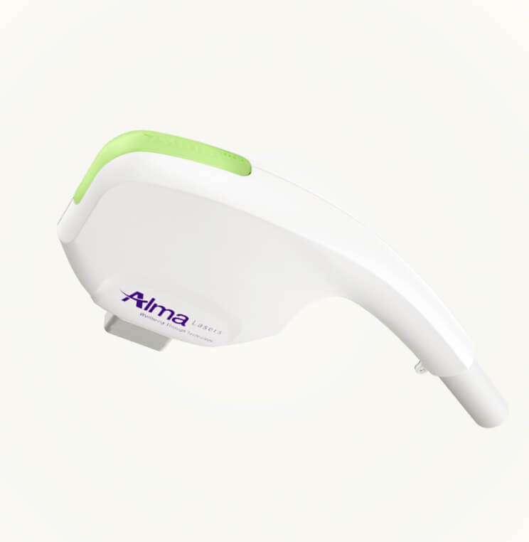 Alma Laser Hair Removal Vancouver | EverYoung Skin Clinic
