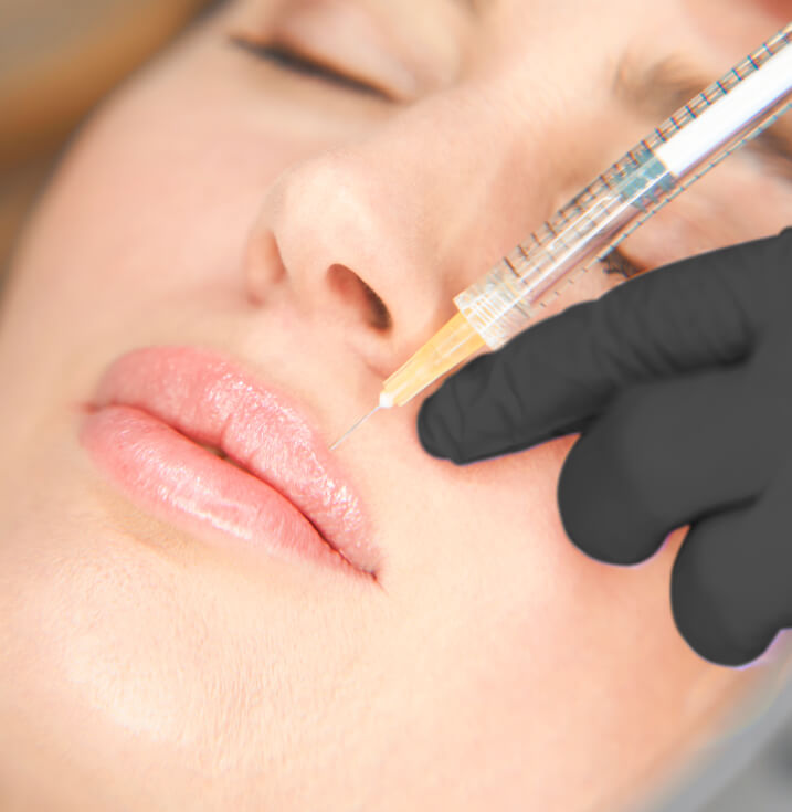 Vancouver Dermal Fillers Clinic | EverYoung Skin Clinic