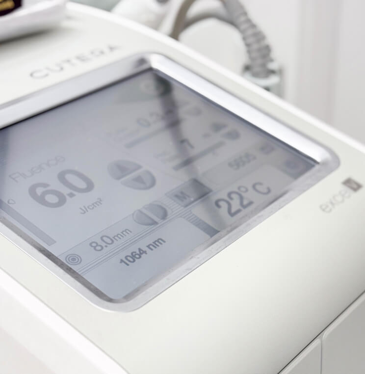 Excel-V Treatment Vancouver | EverYoung Skin Clinic