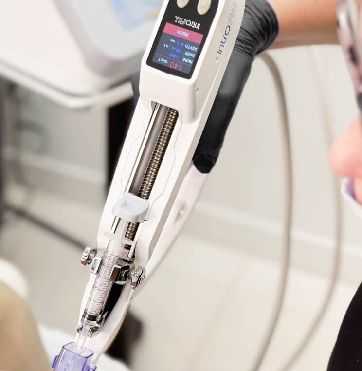 Introfill HA Boost Vancouver | EverYoung Skin Clinic