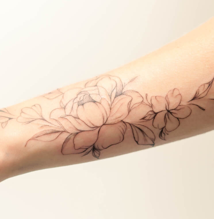 Laser Tattoo Removal Vancouver | EverYoung Skin Clinic