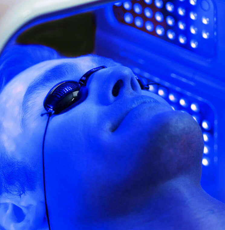 BLU-U® Blue Light Therapy Vancouver | EverYoung Skin Clinic