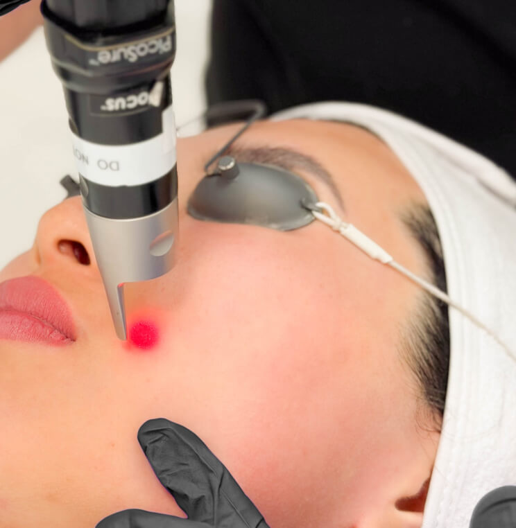 PicoSure Skin Revitalization Vancouver | EverYoung Skin Clinic