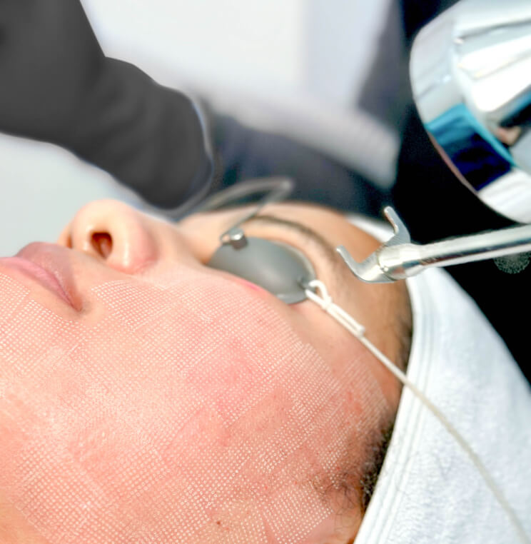 ProFractional™ Laser Resurfacing | EverYoung Skin Clinic Vancouver