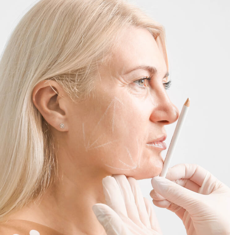 Sculptra® Fillers Vancouver | EverYoung Skin Clinic