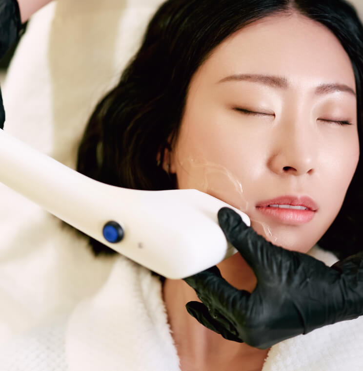 Sofwave™ Vancouver | EverYoung Laser Skin Clinic