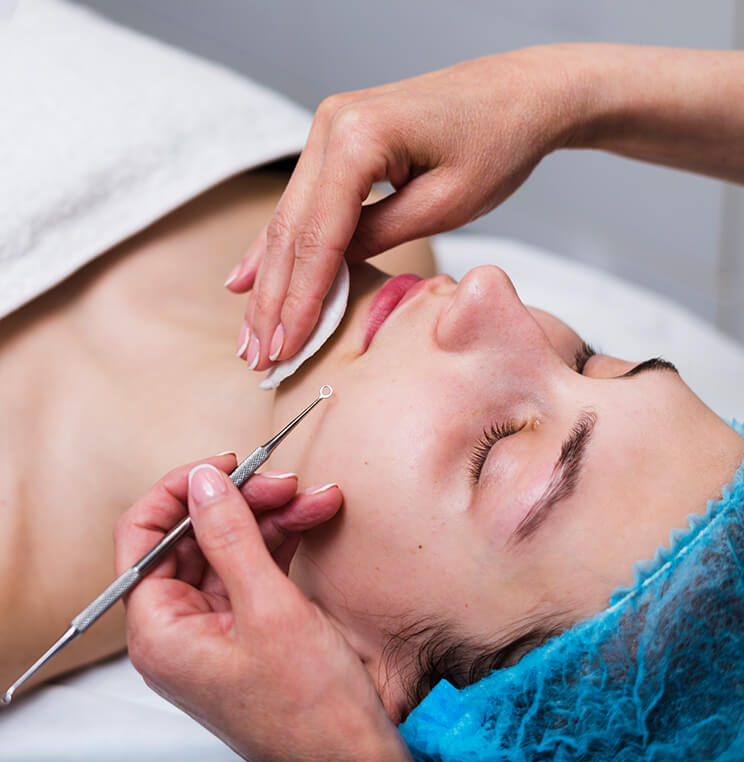 Acne Treatments Vancouver | EverYoung Skin Clinic