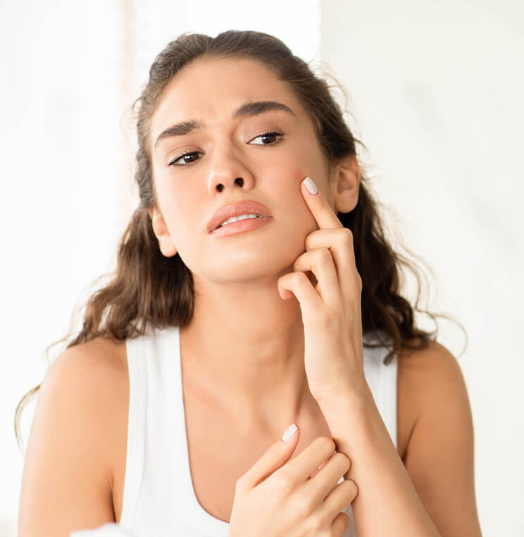 Conditions: Acne | EverYoung Skin Clinic