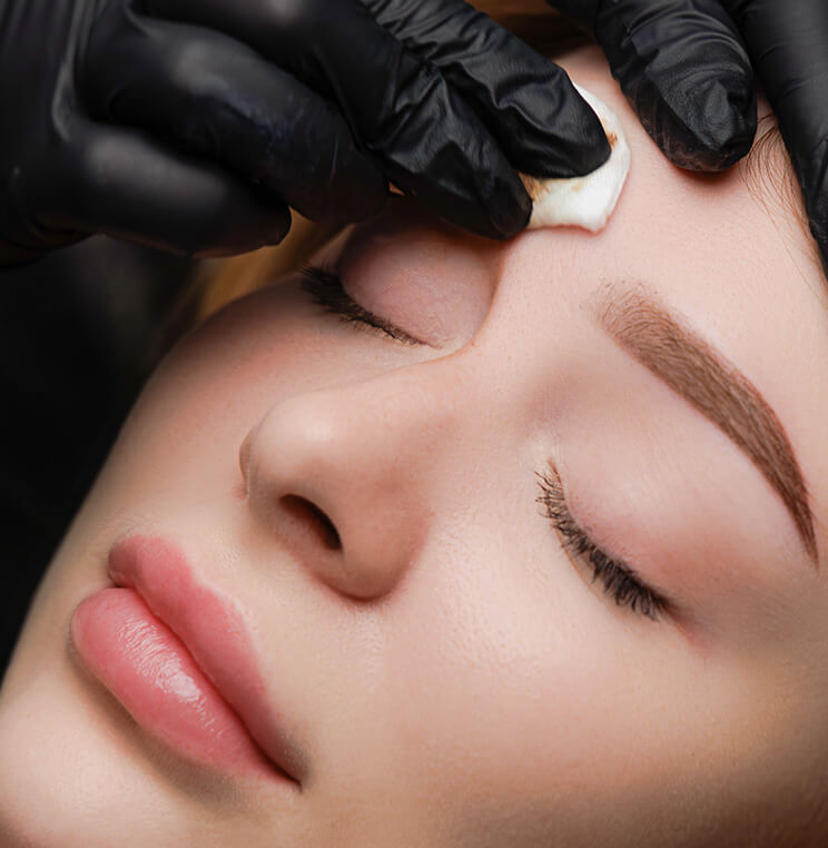 Conditions: Unwanted Facial Tattoos | EverYoung Skin Clinic