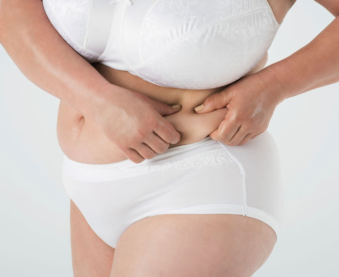 How To Get Rid of Muffin Top | Causes & Tips | EverYoung Skin Clinic