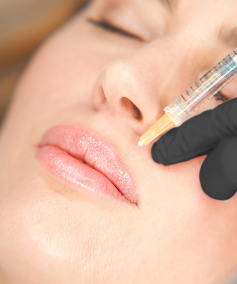 Lip Fillers & Injections Vancouver, Burnaby & North Vancouver | EverYoung Skin Clinic