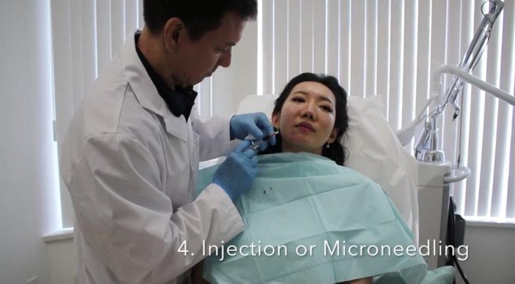 injection-microneedling-eym-vancouver