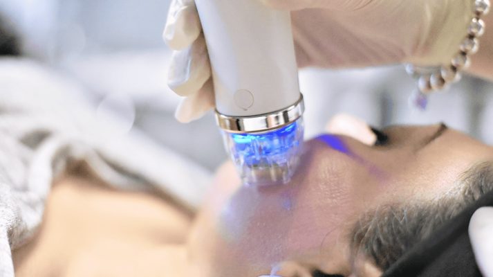 Microneedling | EverYoung Skin Care Clinic